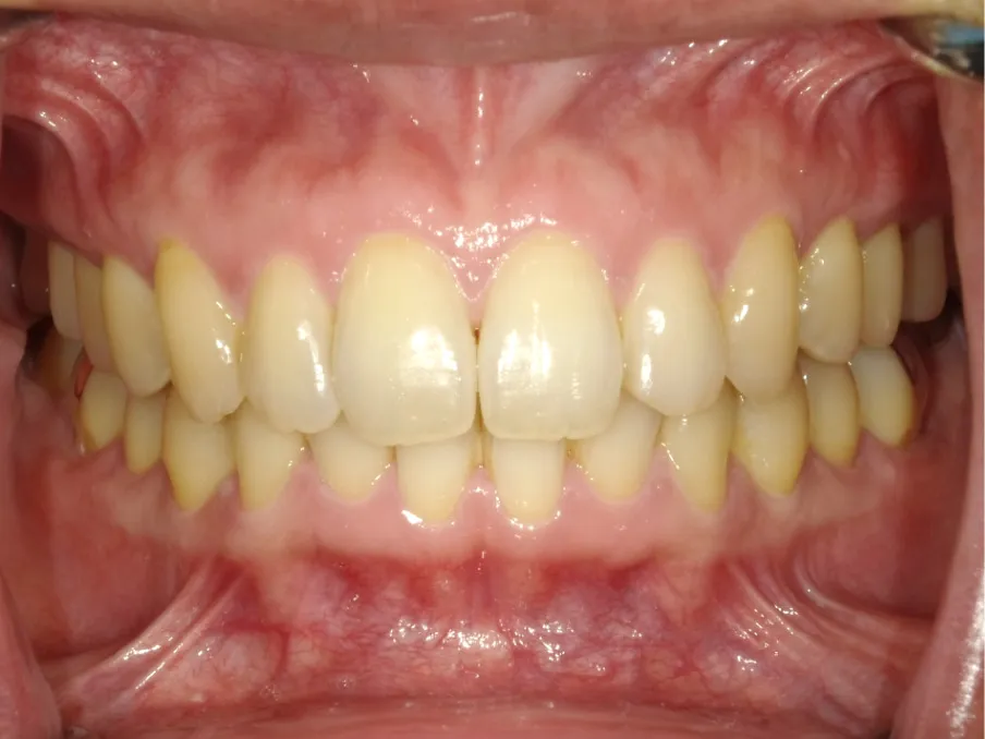 CASE09