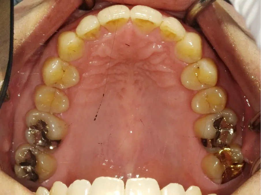 CASE09