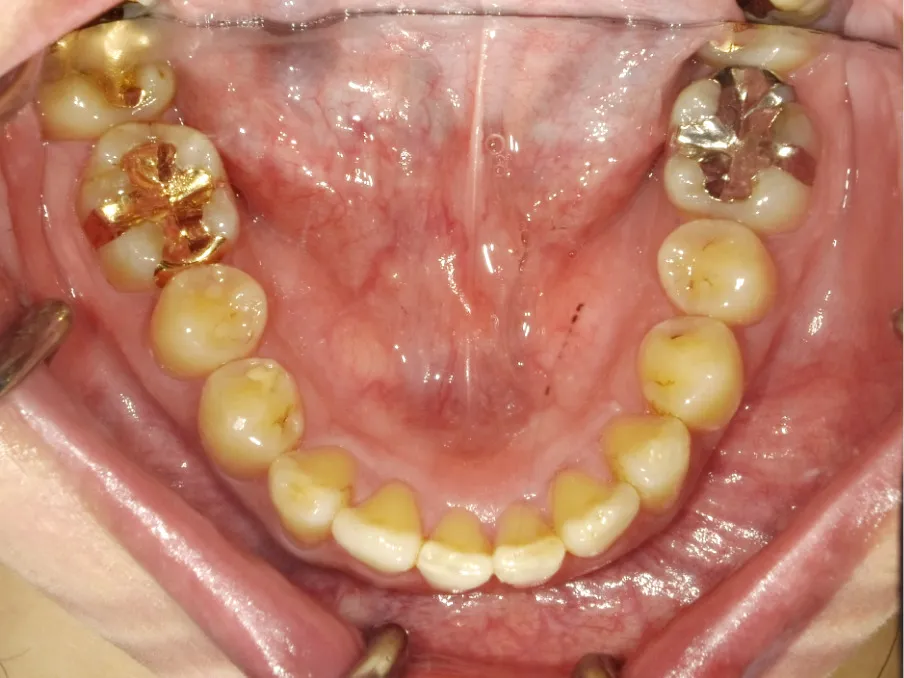 CASE09