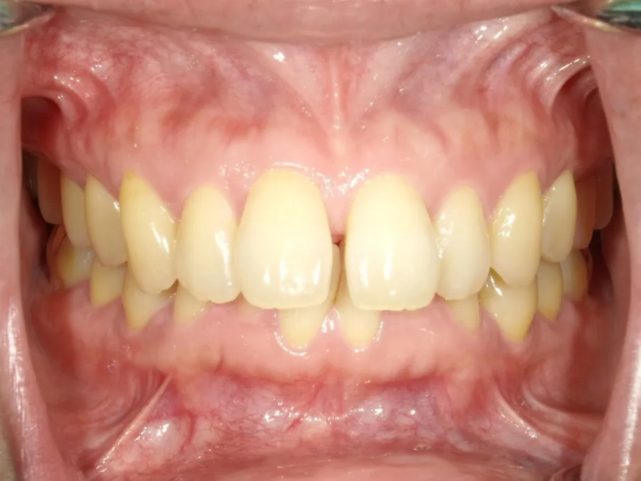 CASE09