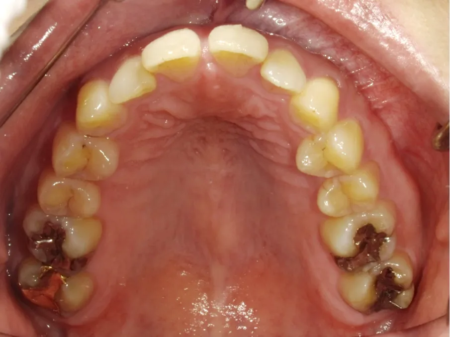 CASE09